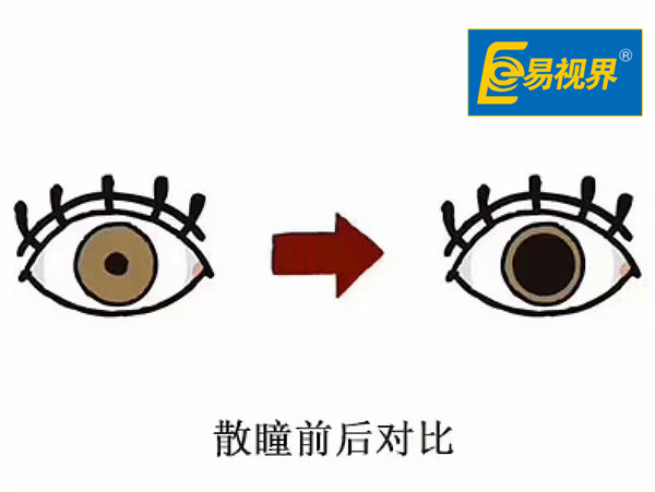 散瞳的影響有哪些【易視界】