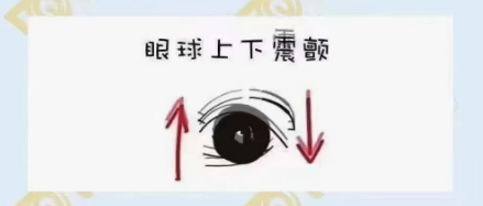什么是眼球震顫？